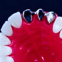 Zirconia Bridge in Mumbai, India