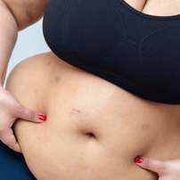 Laparoscopic Gall Bladder Removal in Tijuana, Mexico