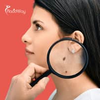 Targeted TILs Therapy for Skin Cancer Treatment Package in Beijing, China by Bioocus Biotech