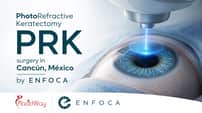 PRK Eye Surgery in Cancun by ENFOCA