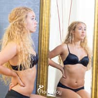 Affordable and Effective Rhinoplasty Package in Seoul, South Korea