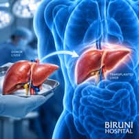 Liver Transplant Package in Istanbul Turkey by Biruni Hospital