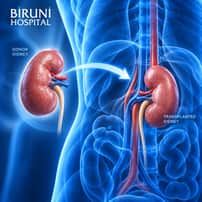 Kidney Transplant Package in Istanbul Turkey by Biruni Hospital
