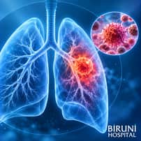 Lung Cancer Treatment Package in Istanbul Turkey by Biruni Hospital