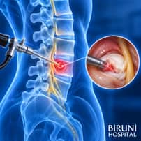 Percutaneous Endoscopic Lumbar Discectomy (PELD) Package in Istanbul Turkey by Biruni Hospital