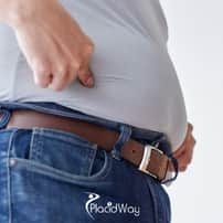 Best Gastric Balloon Package in Tijuana, Mexico