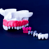 Top Package For Porcelain Veneers in Medellin, Colombia | Best Dentists in Colombia