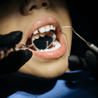 Thorough Dental Check up Package in Seoul