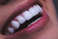 Smile Makeover Package at Sonrisa Italiana - Dental Clinic Colombia, Barranquilla, Colombia