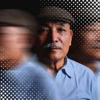 Top Package for Parkinson's Disease Stem Cell Treatment in Vienna, Austria