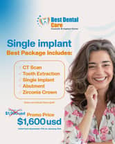 Limited-Time Dental Implant Promotion
