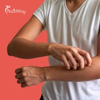 Paquete de terapia con células madre para la psoriasis en Tijuana, México, de CellsTime