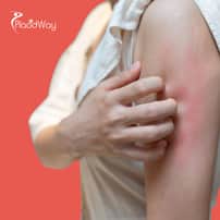 Stem Cell Therapy for Lyme Disease Package in Tijuana, Mexico by CellsTime Clinique