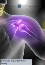 Arthroscopic Rotator Cuff Surgery in Bursa/İstanbul, Turkey