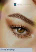 Brow Lift (Browplasty Surgery)