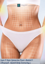 Laser & Vaser Liposuction (Laser-Assisted & Ultrasound- Assisted Body Contouring) 