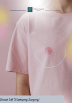 Breast Lift (Mastopexy Surgery) 