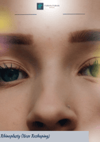 Rhinoplasty Package in Istanbul, Turkey by Turan Turan
