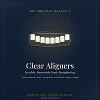 Invisible Aligners Package at House of Dontics Dental Clinic in Ahmedabad, India , Ahmedabad, India