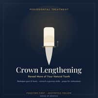 Crown lengthening Package at House of Dontics Dental Clinic in Ahmedabad, India , Ahmedabad, India