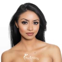 Complete Rhinoplasty Surgery Package in Tijuana, Mexico