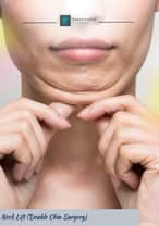 Neck Liposuction Package in Istanbul, Turkey by Turan Turan