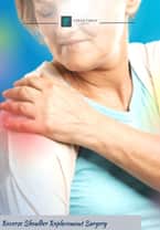 Reverse Shoulder Replacement Surgery Package in Istanbul, Turkey by Turan Turan