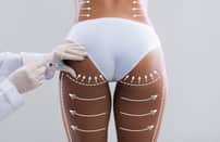 Brazilian Butt Lift (BBL)