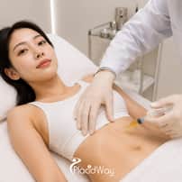 Fat Grafting and Body Sculpting Package in Gangnam, South Korea – Volume Contouring
