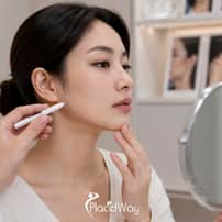 Cheekbone Reduction Package in Gangnam, South Korea – Facial Width Contouring