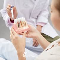 Full Mouth Dental Implants in Turkey Package Deals