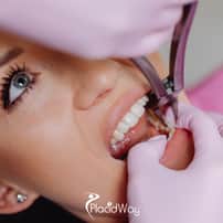 Affordable All on 4 Dental Implants Package in Izmir, Turkey