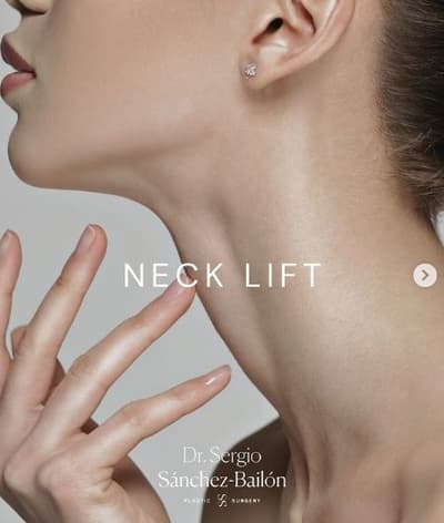 Neck Lift Tijuana Mexico Package by Dr. Sergio Sanchez