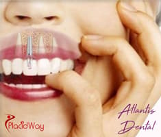 Slider image (3) Atlantis Dental