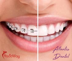 Slider image (4) Atlantis Dental