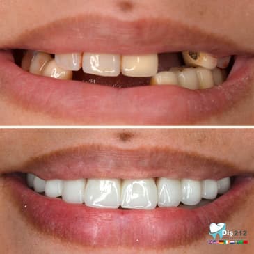 Slider image (2) Dis 212 - Dental Aesthetics Facility