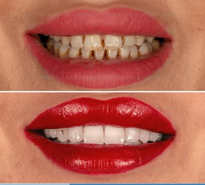 Slider image (9) Dis 212 - Dental Aesthetics Facility