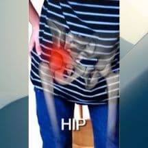 Slider image (3) Dr. Maximilian A. Greig - Orthopedic Surgery in Mexico