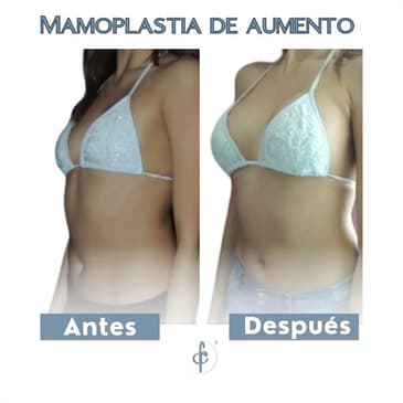 Slider image (2) Dr. Felipe Castro Esguerra - Plastic Surgeon in Colombia