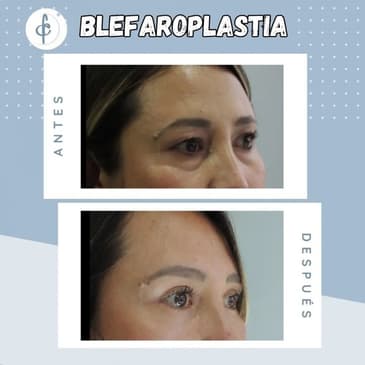Slider image (3) Dr. Felipe Castro Esguerra - Plastic Surgeon in Colombia