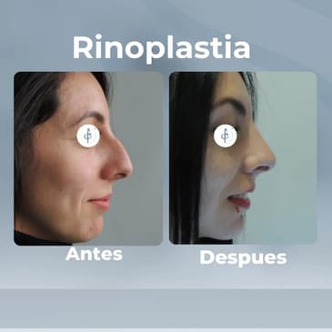 Slider image (6) Dr. Felipe Castro Esguerra - Plastic Surgeon in Colombia
