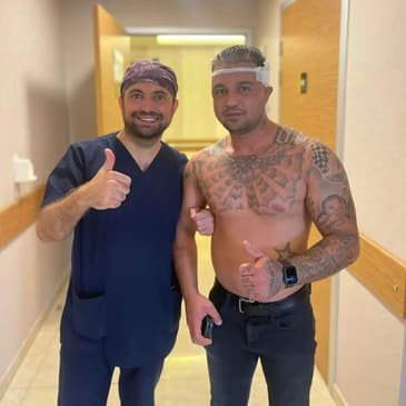 Slider image (2) Transes Hair Transplant