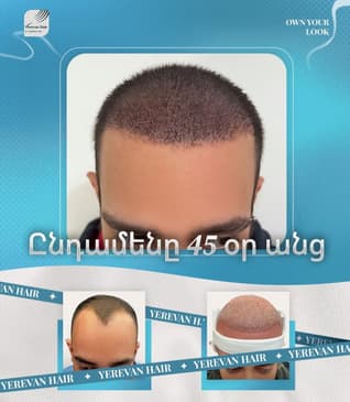 Slider image (1) United Hair Clinic