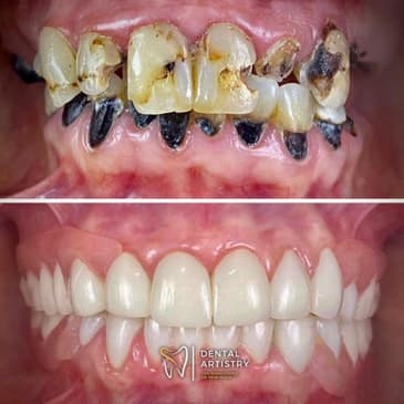 Slider image (4) Dental Artistry Dental Center