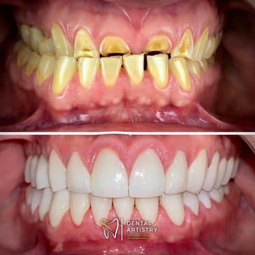 Slider image (7) Dental Artistry Dental Center