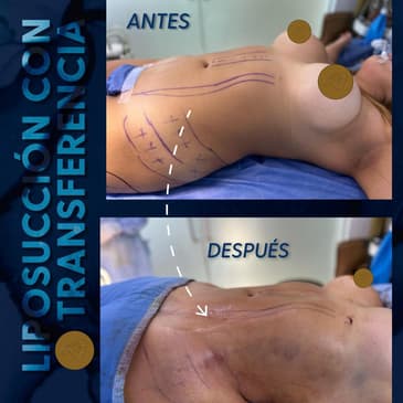 Slider image (4) Dr. Eduardo Cartagena - Plastic Surgeon in Mexico City