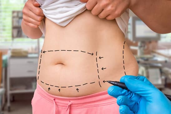 Slider image (3) Dr. Asim Uslu - Plastic Surgeon in Antalya, Turkey
