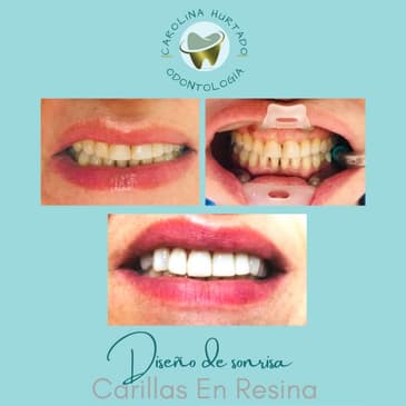 Slider image (2) Carolina Hurtado Odontologia Integral in Bogota, Colombia