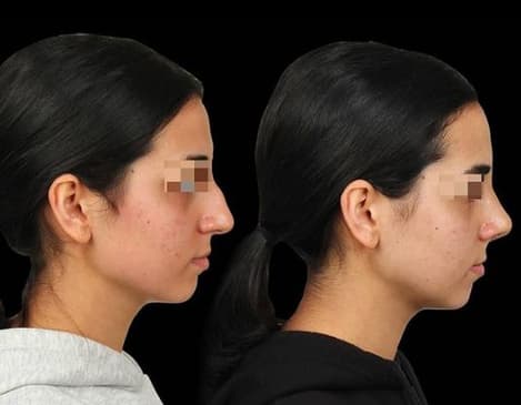 Slider image (4) The Nose Aesthetic Clinic