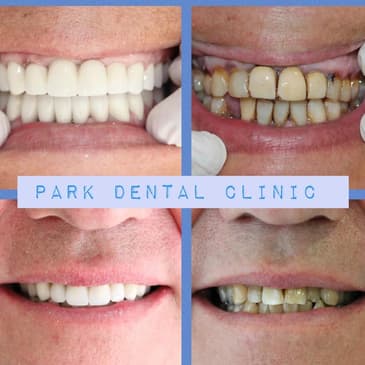 Slider image (6) Park Dental Clinic
